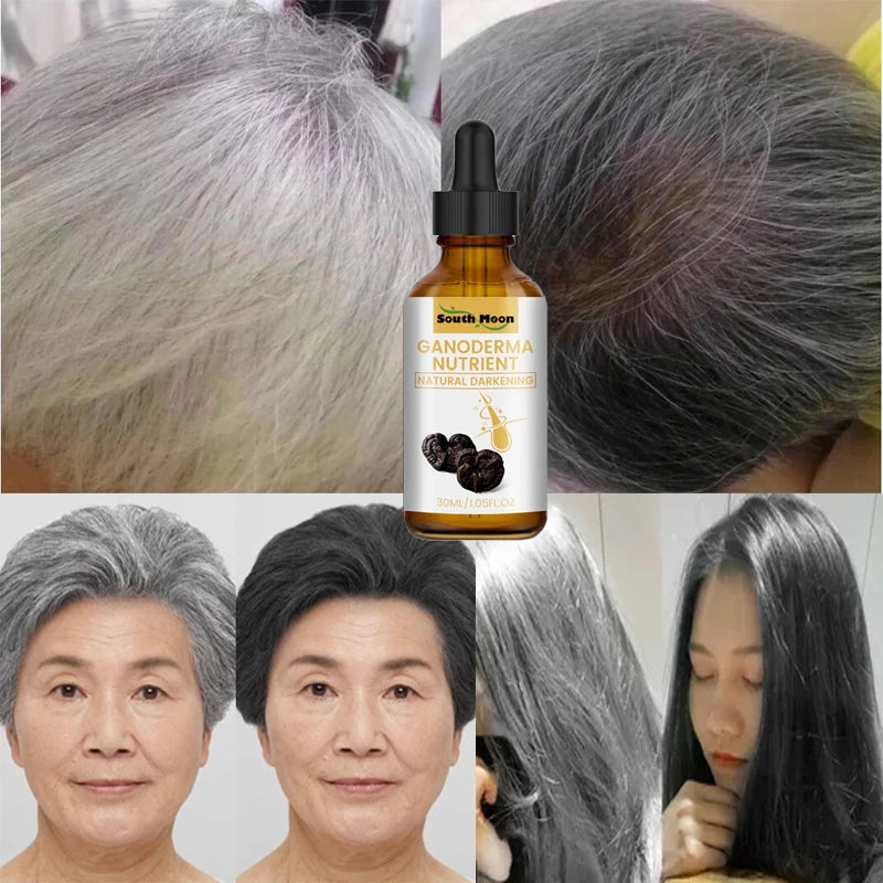 "10PCS Gray to Black Hair Treatment Serum: Natural Color Repair for Men and Women"