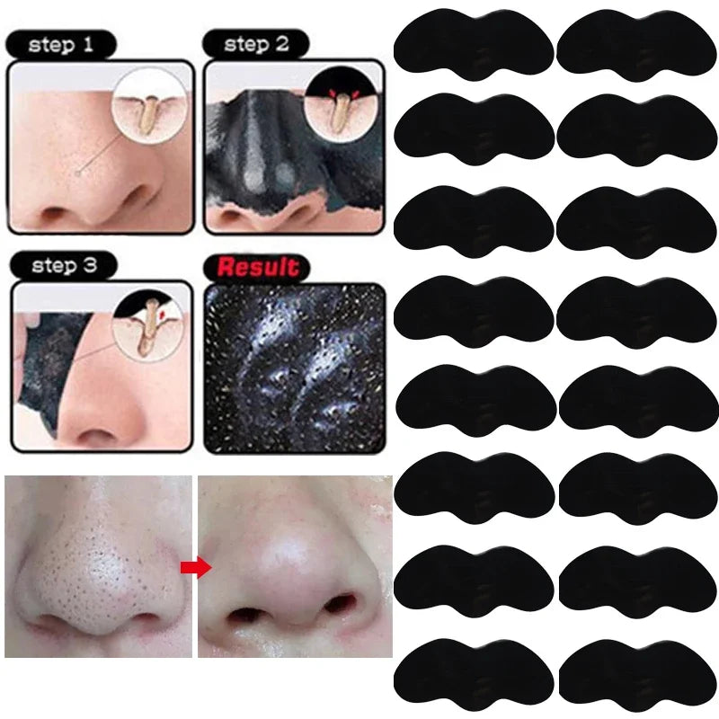 "Deep Cleansing Nose Blackhead Remover Mask: Oil-Control for Acne and Black Dots"