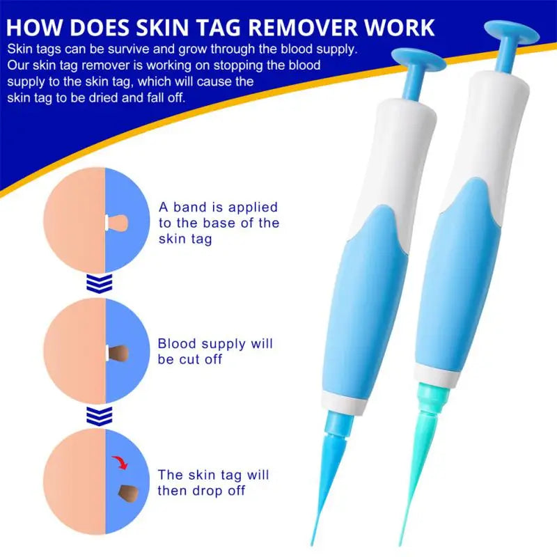 "Double-Head Auto Skin Tag Remover: Painless Mole and Wart Removal Kit with Cleansing Swabs"