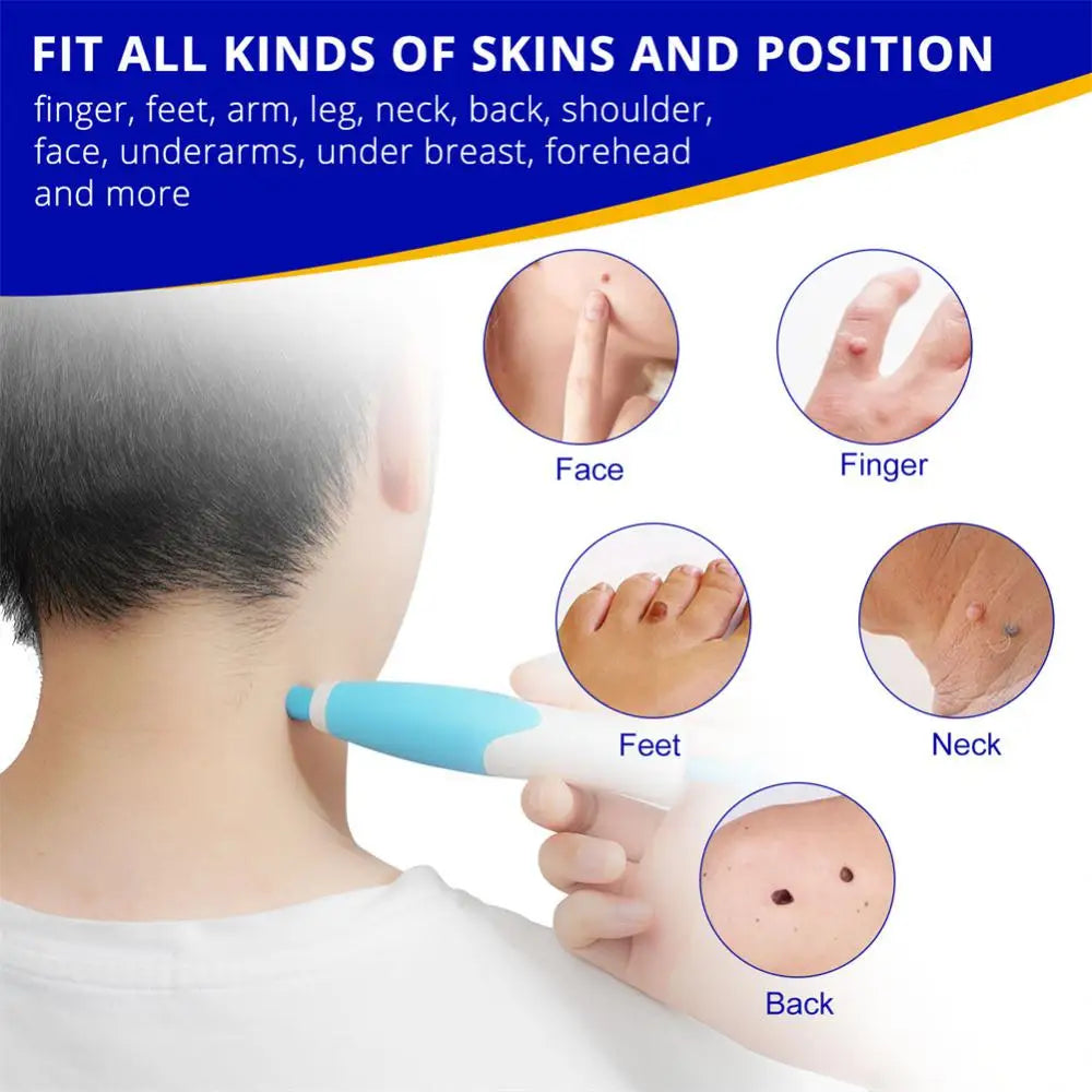 "Double-Head Auto Skin Tag Remover: Painless Mole and Wart Removal Kit with Cleansing Swabs"