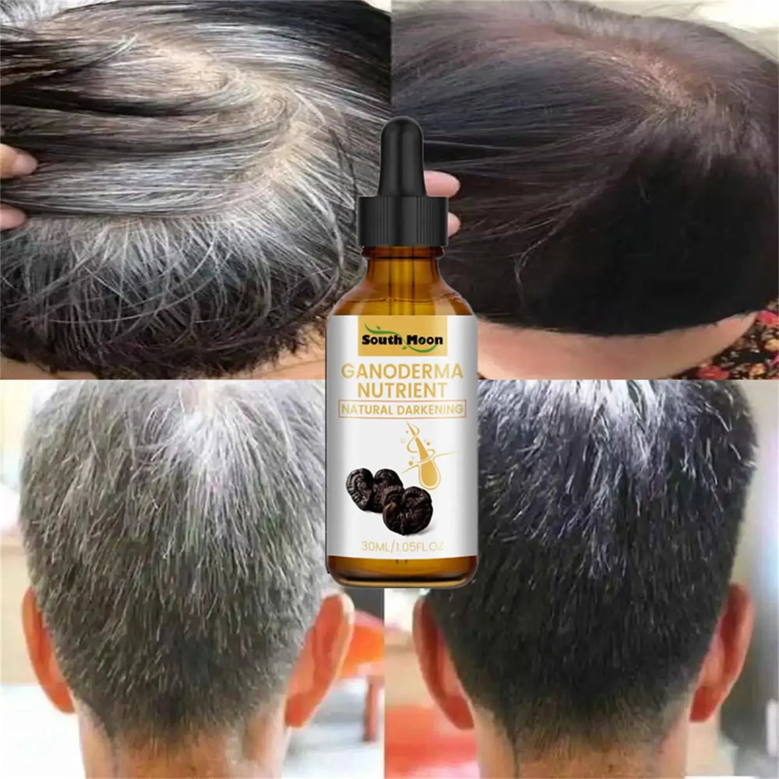 "Gray to Black Hair Treatment Serum: Natural Color Repair for Men and Women"