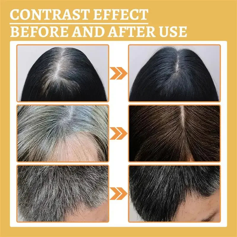 "Gray to Black Hair Treatment Serum: Natural Color Repair for Men and Women"