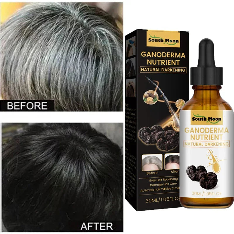 "Gray to Black Hair Treatment Serum: Natural Color Repair for Men and Women"